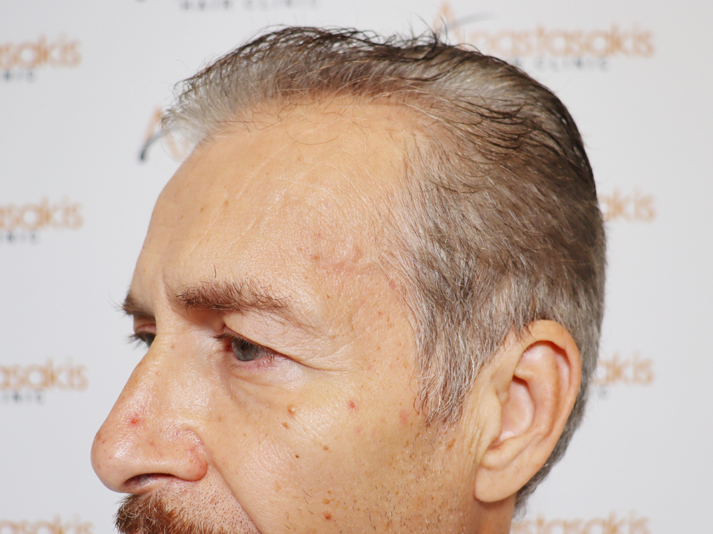 Ανώνυμο σχέδιο (17).png