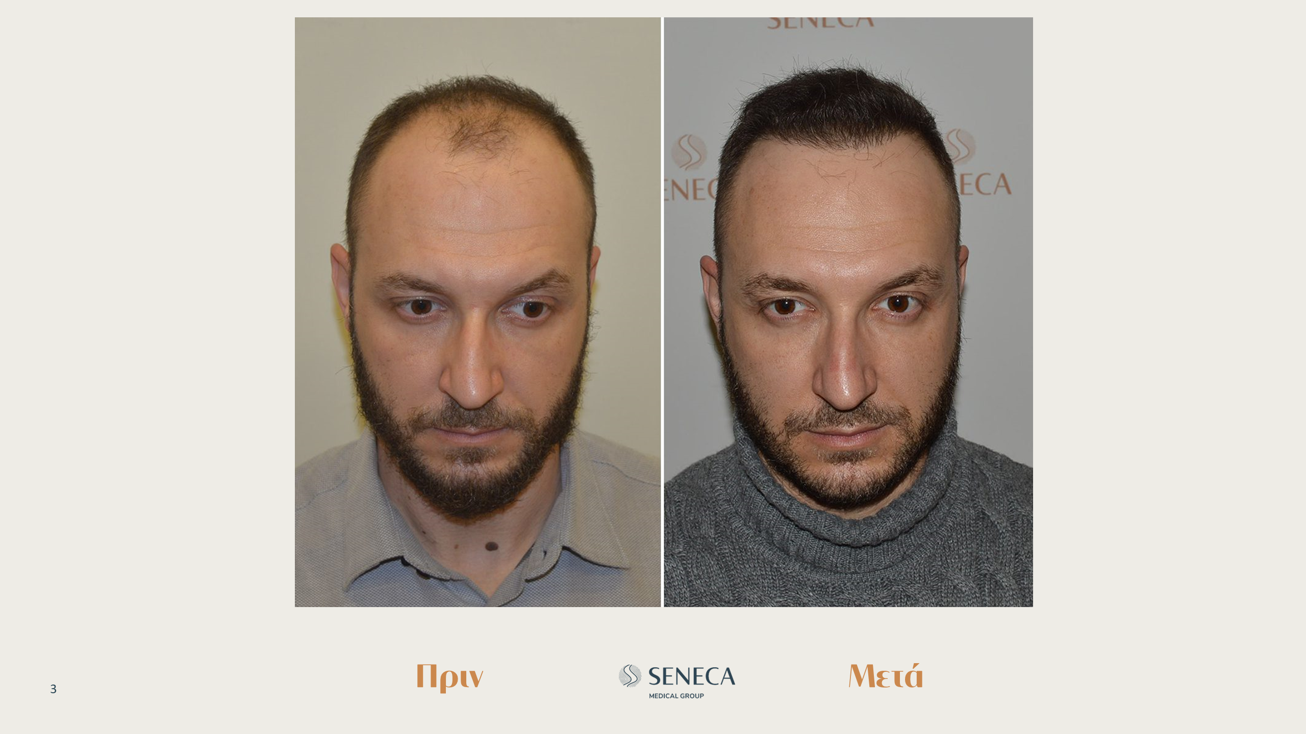 Διαφάνεια3.PNG