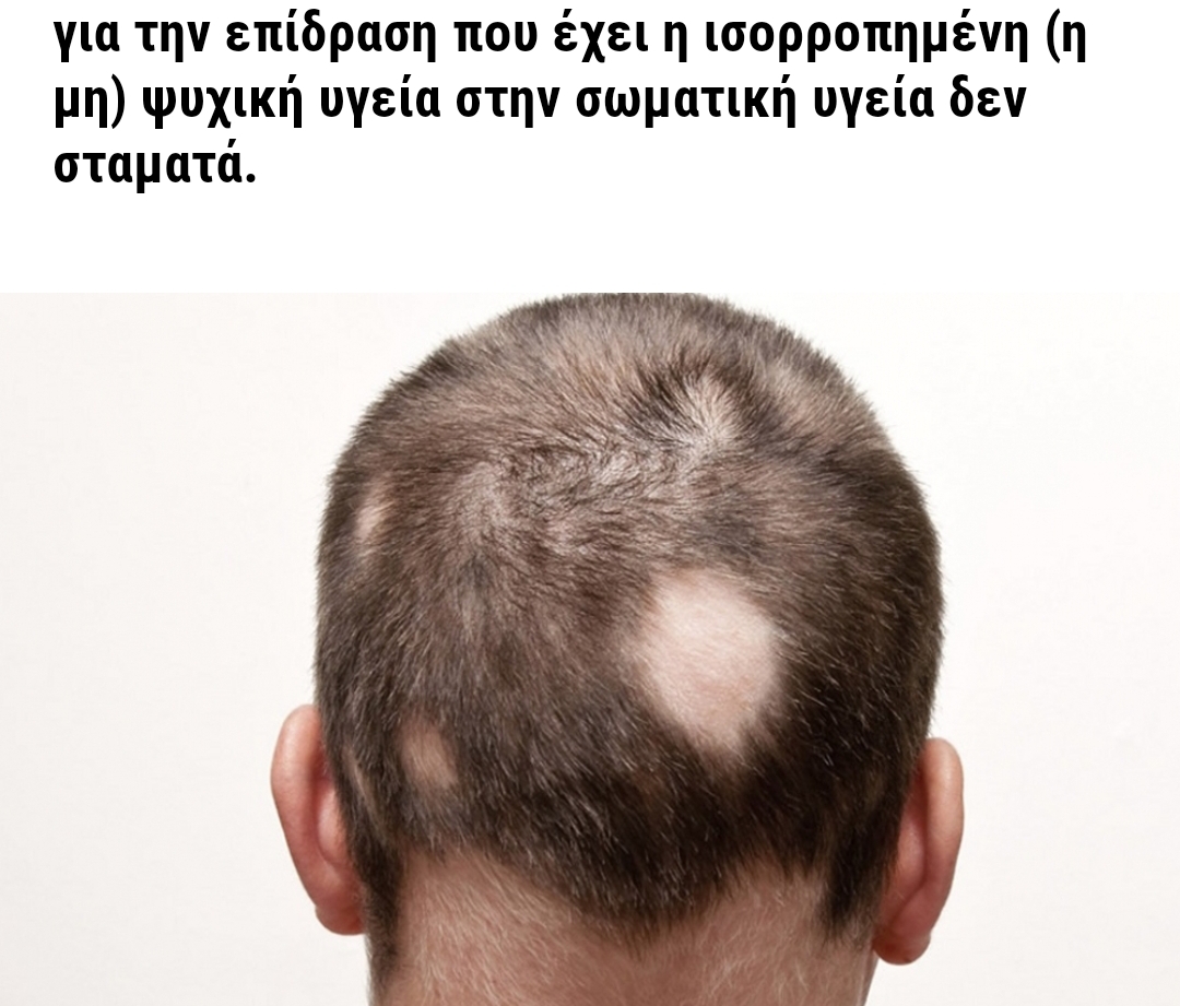 αγχος τριχοπτωση.jpg