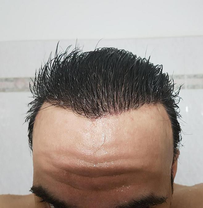 βρεγμενα πισω.jpg