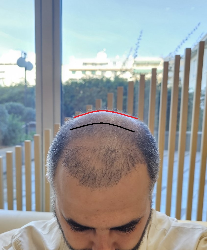 μπροστά σεν2.jpg