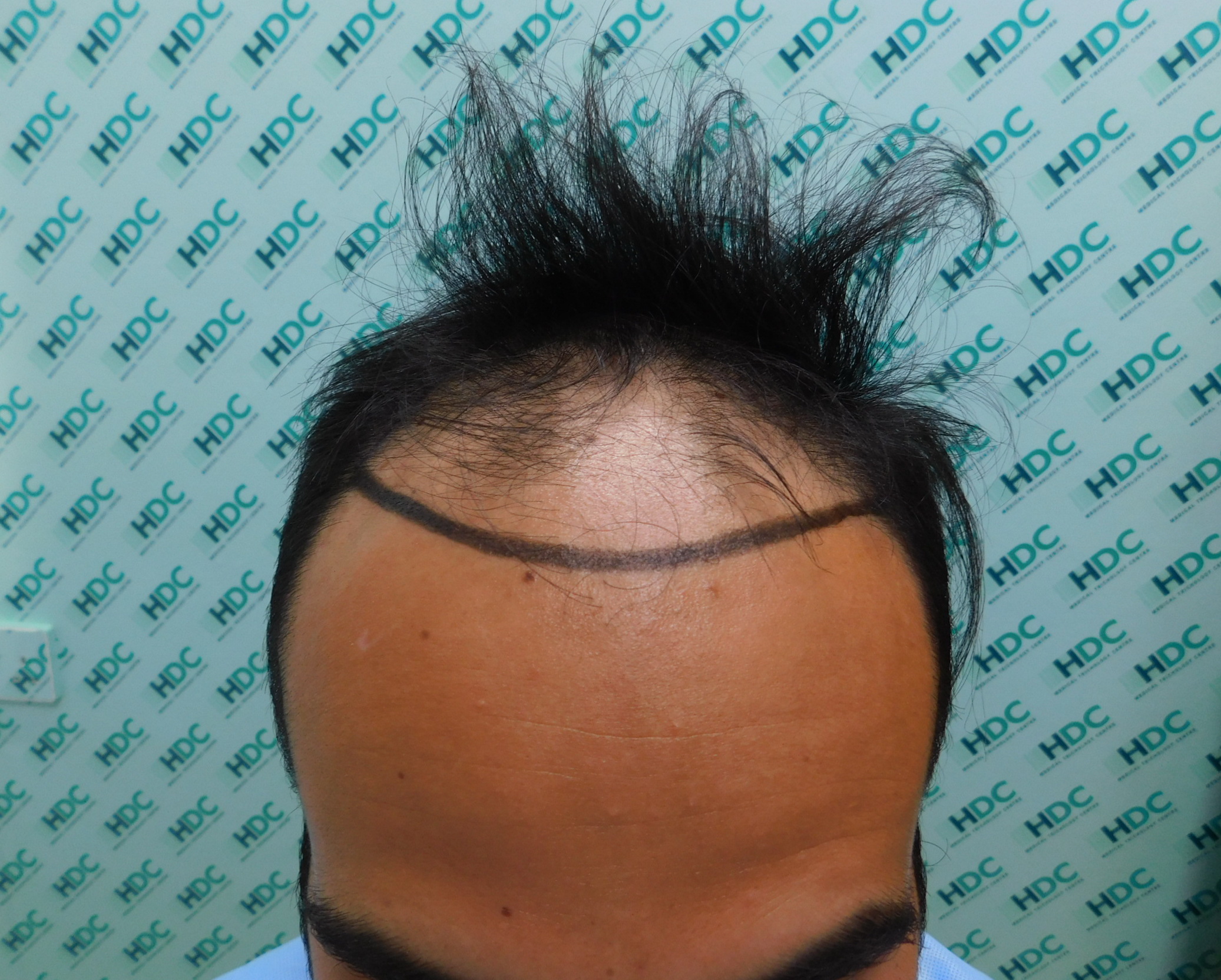 01.jpg