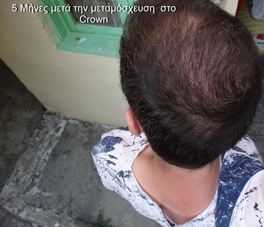 03.JPG