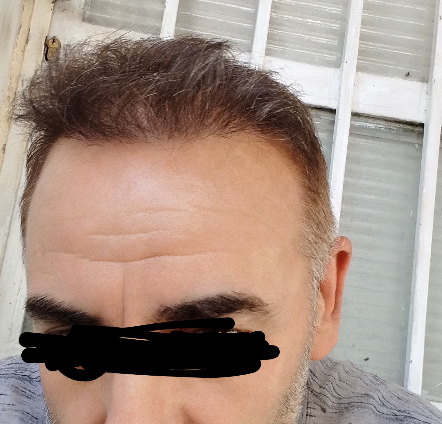 1000003178.jpg