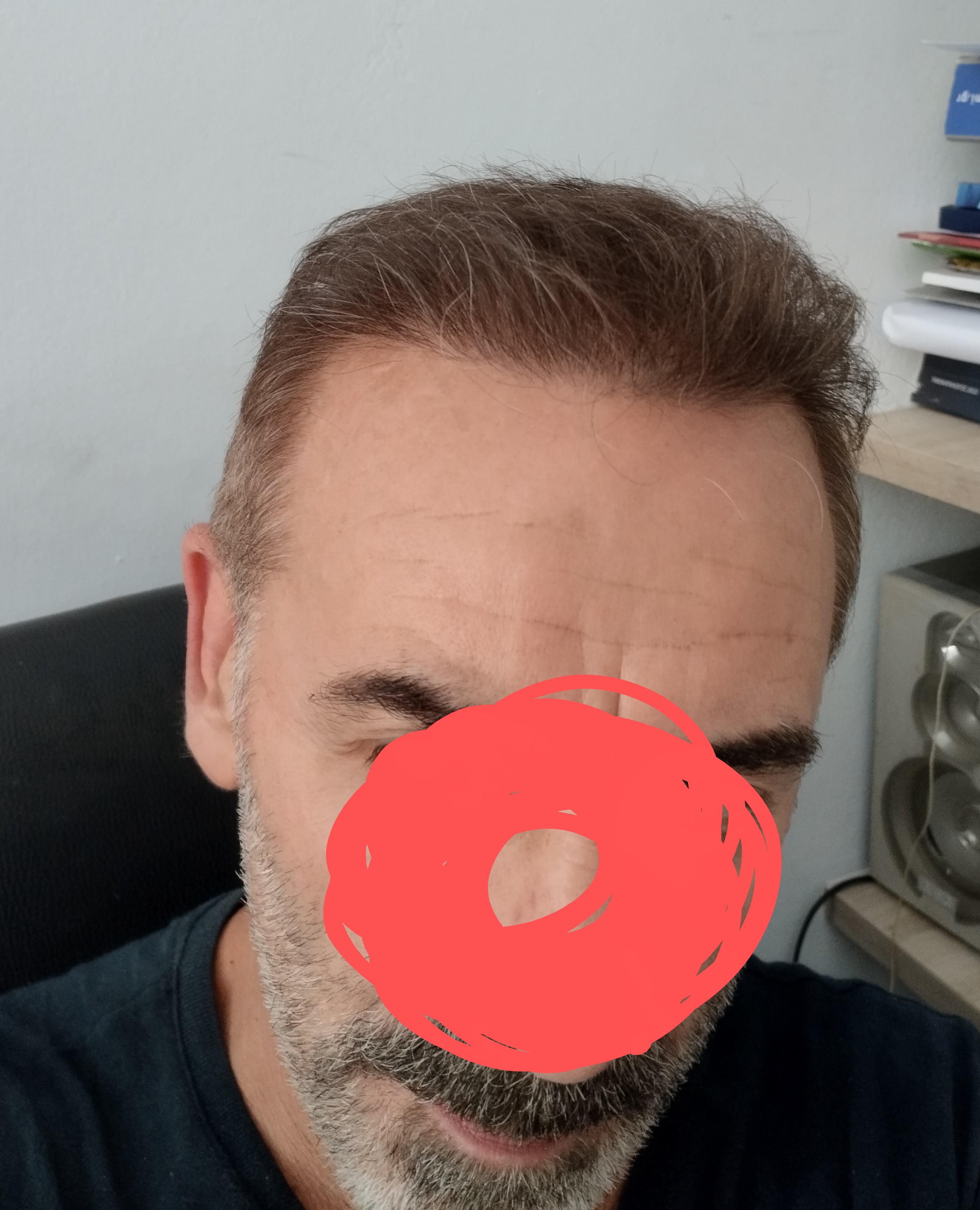 1000003587.jpg