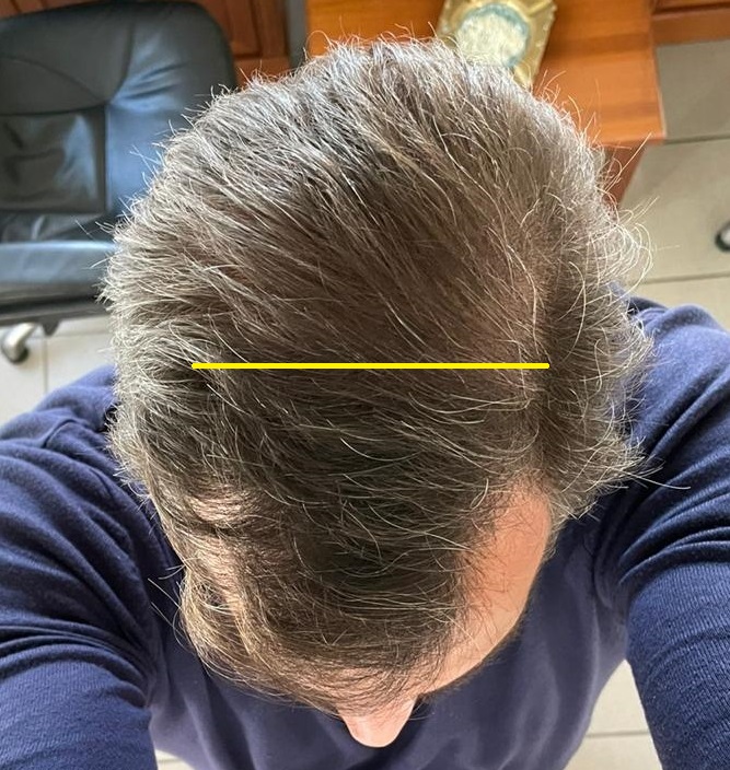 12 MONTHS -1.jpg