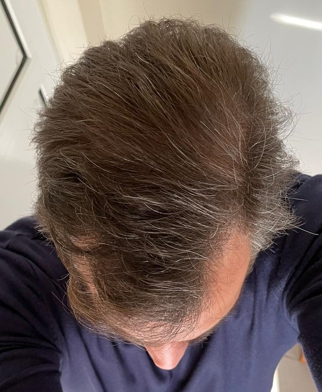 12 MONTHS -2.jpg