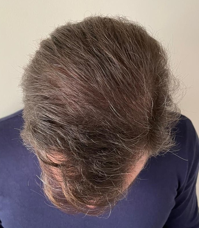 12 MONTHS -3.jpg