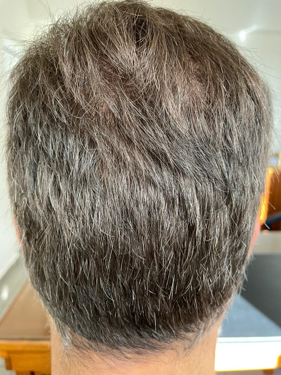 12 MONTHS -5.jpg