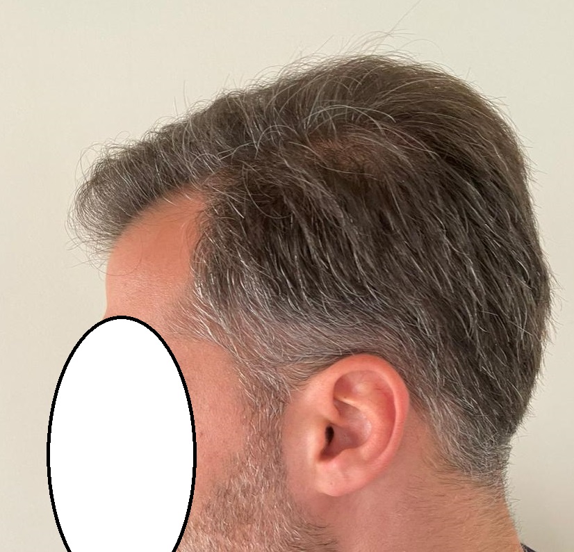 12 MONTHS -7.jpg