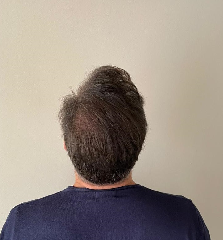12 MONTHS -8.jpg