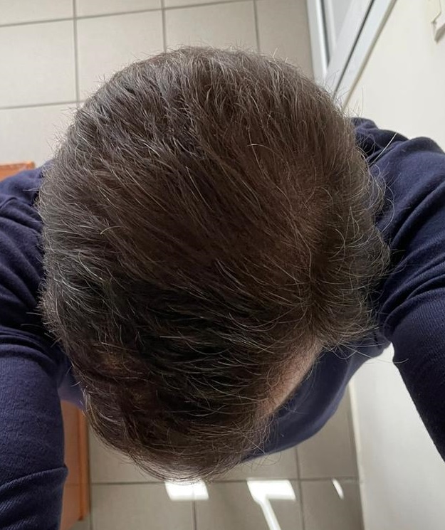 12 MONTHS -9.jpg