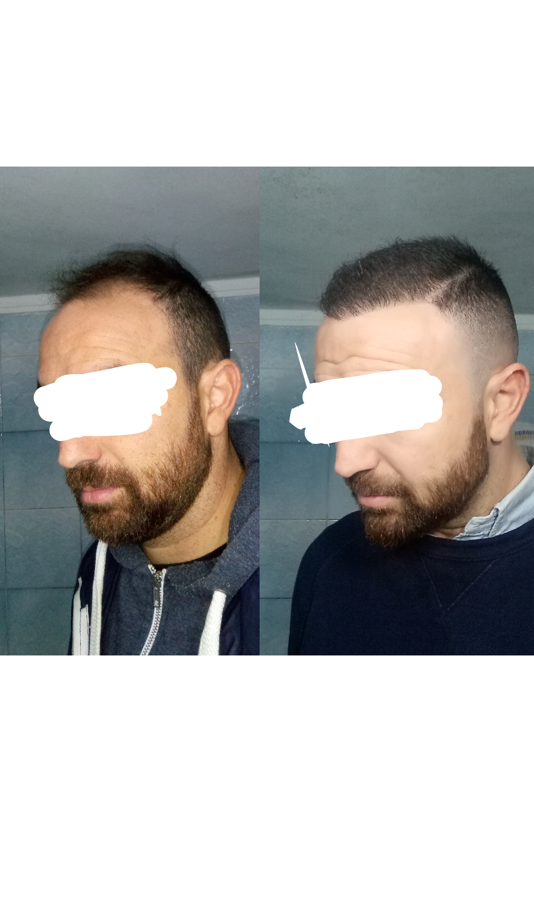 1522188227880_trimmed.png