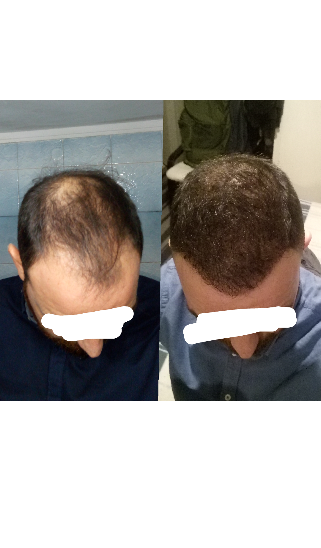 1522188250287_trimmed.png