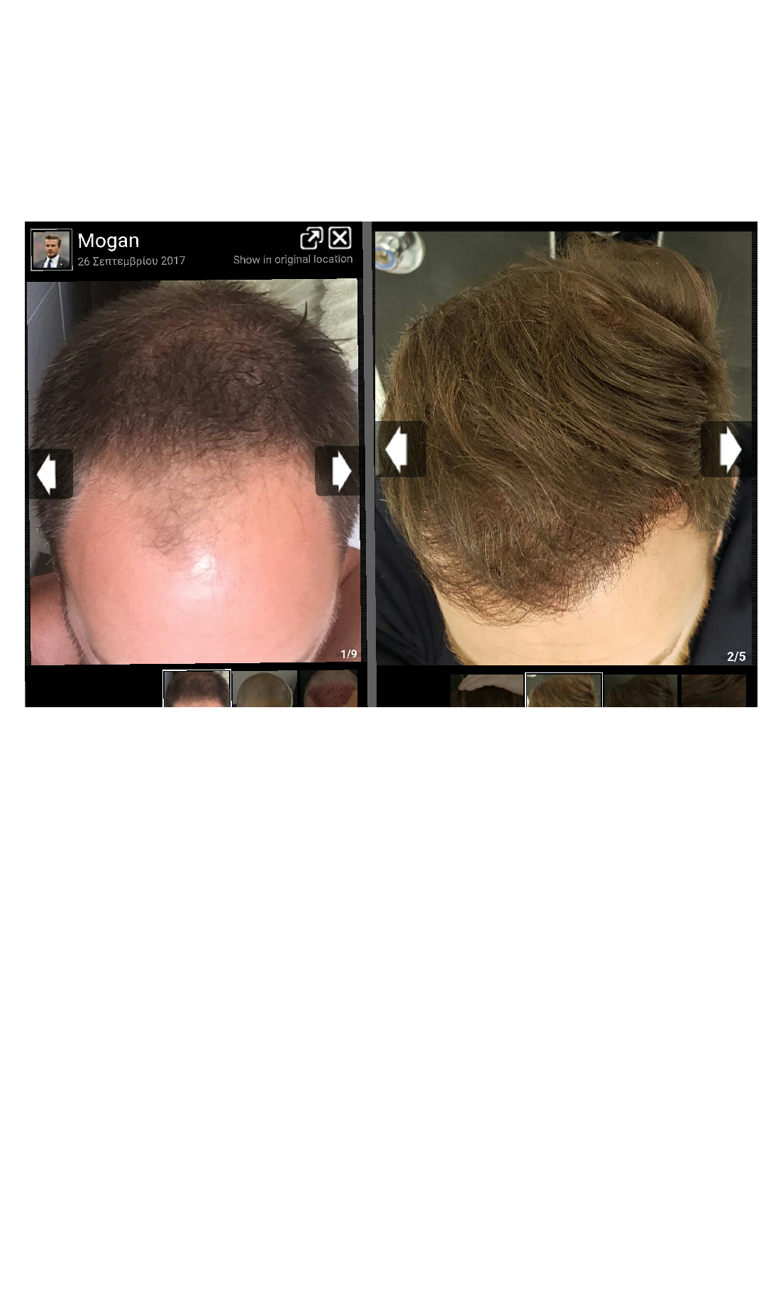 1522503933752_trimmed.png