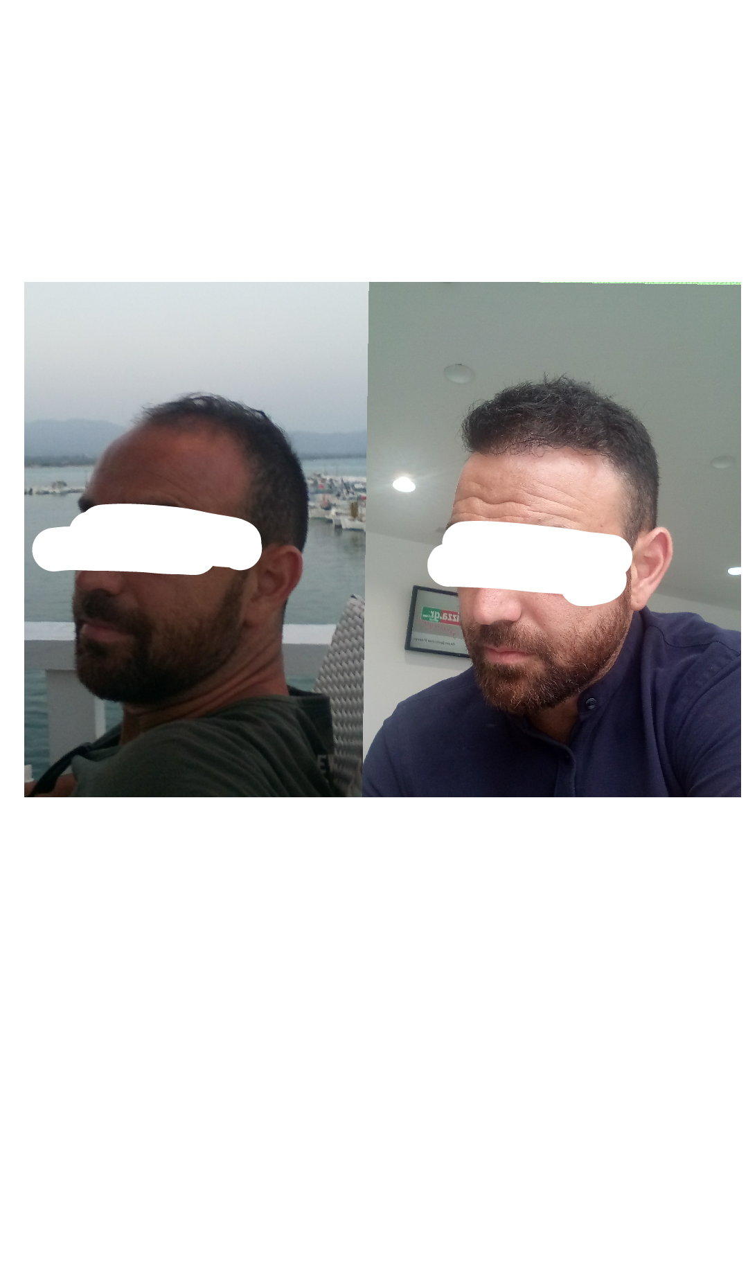 1528718710757_trimmed.png