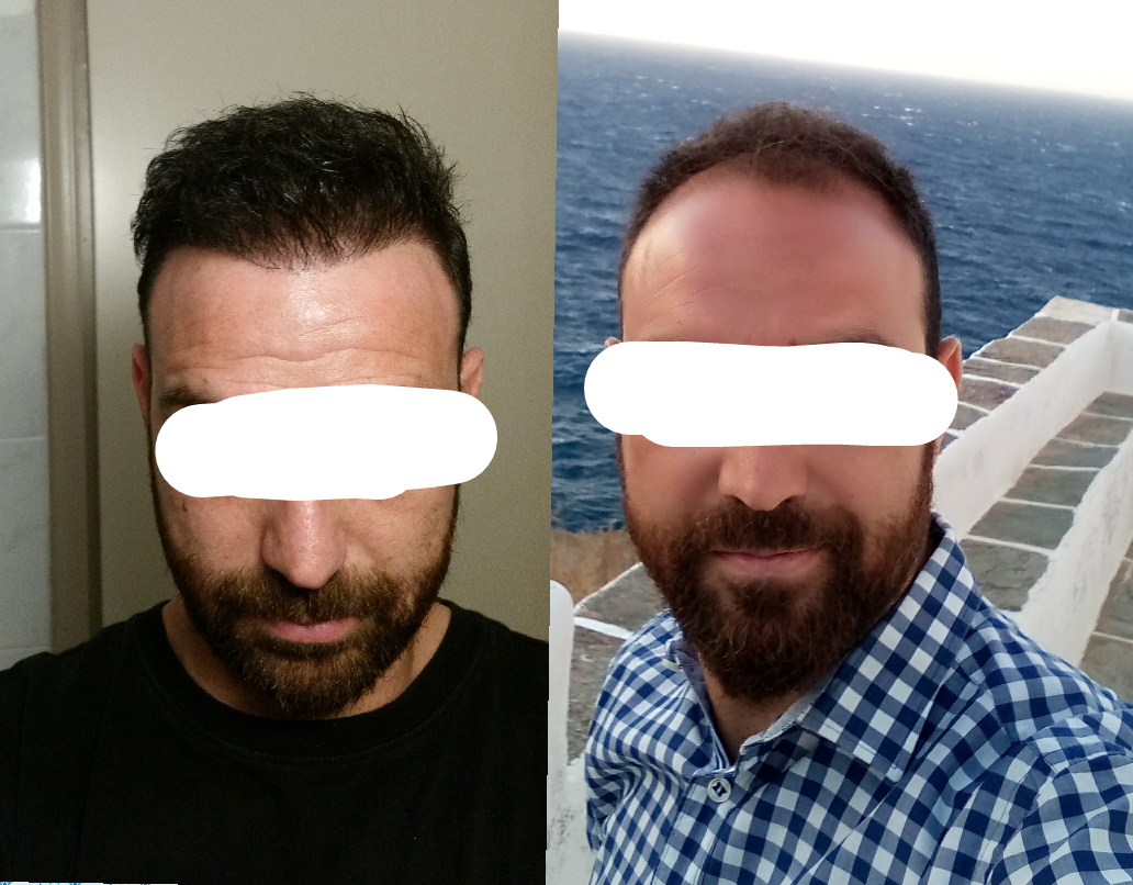 1532439593199_trimmed.png