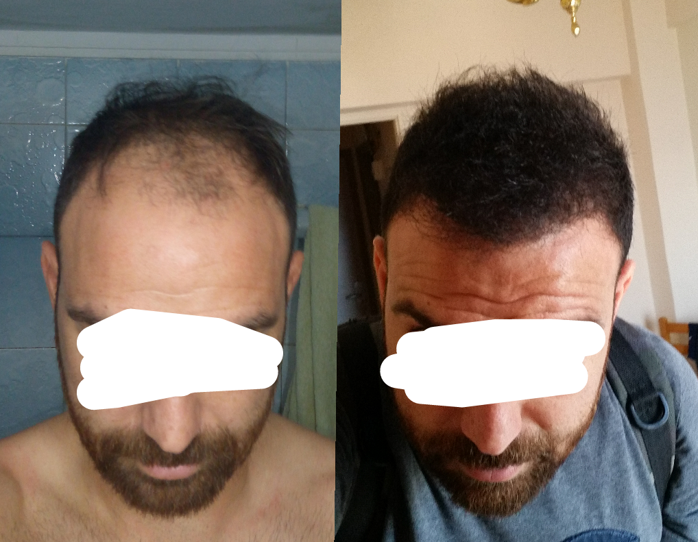 1532440853101_trimmed.png