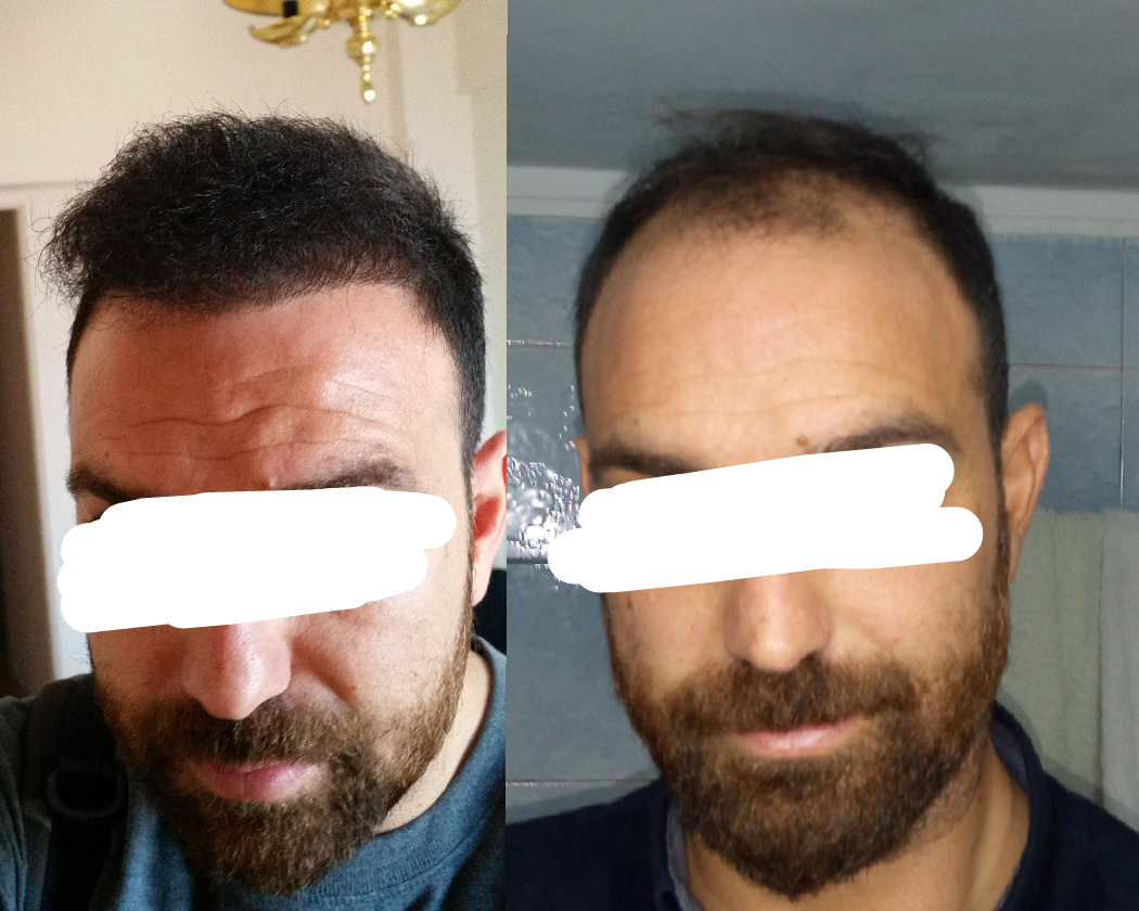 1532440969848_trimmed.png