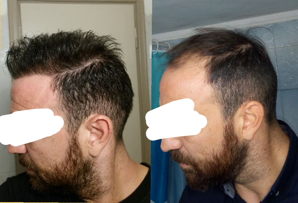1532441010464_trimmed.png