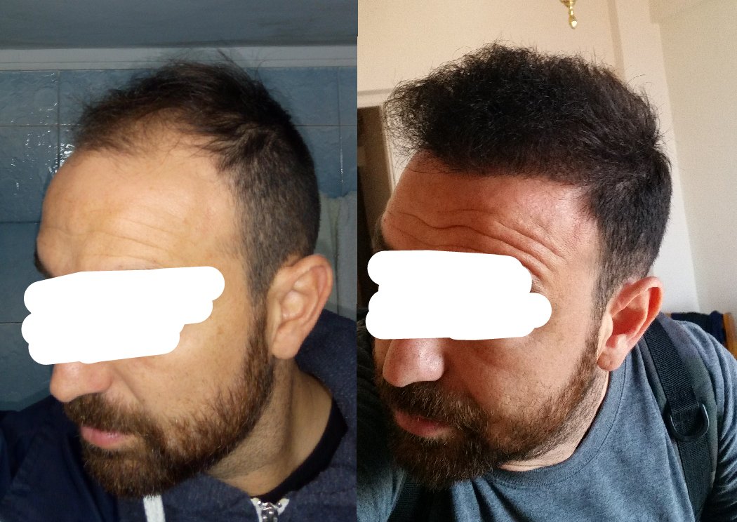 1532441105099_trimmed.png