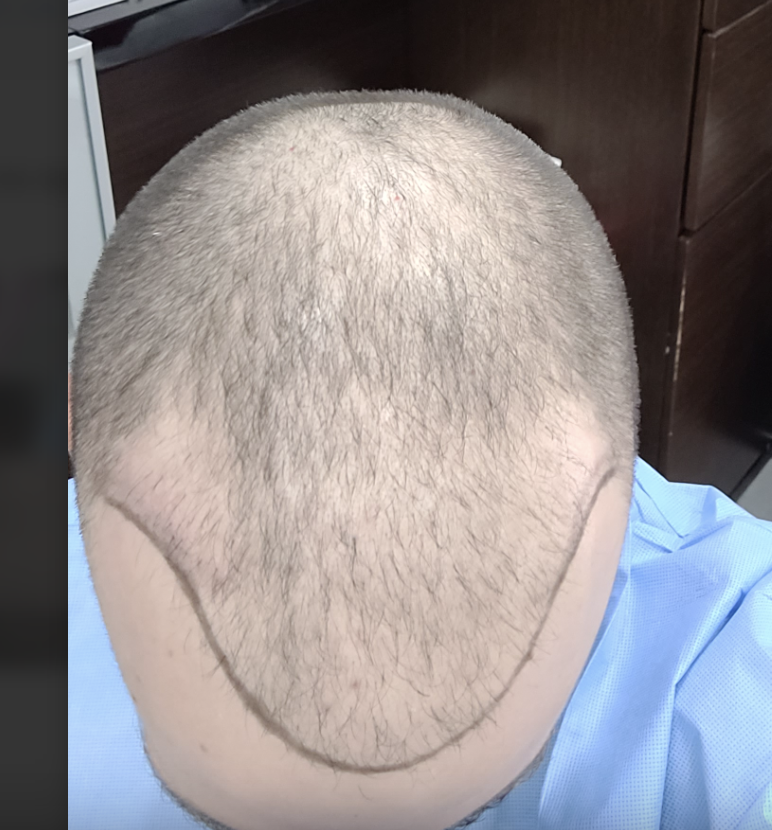 1739317870733.png