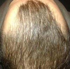 20160216_184617.jpg
