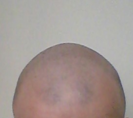 20160307_102116.jpg