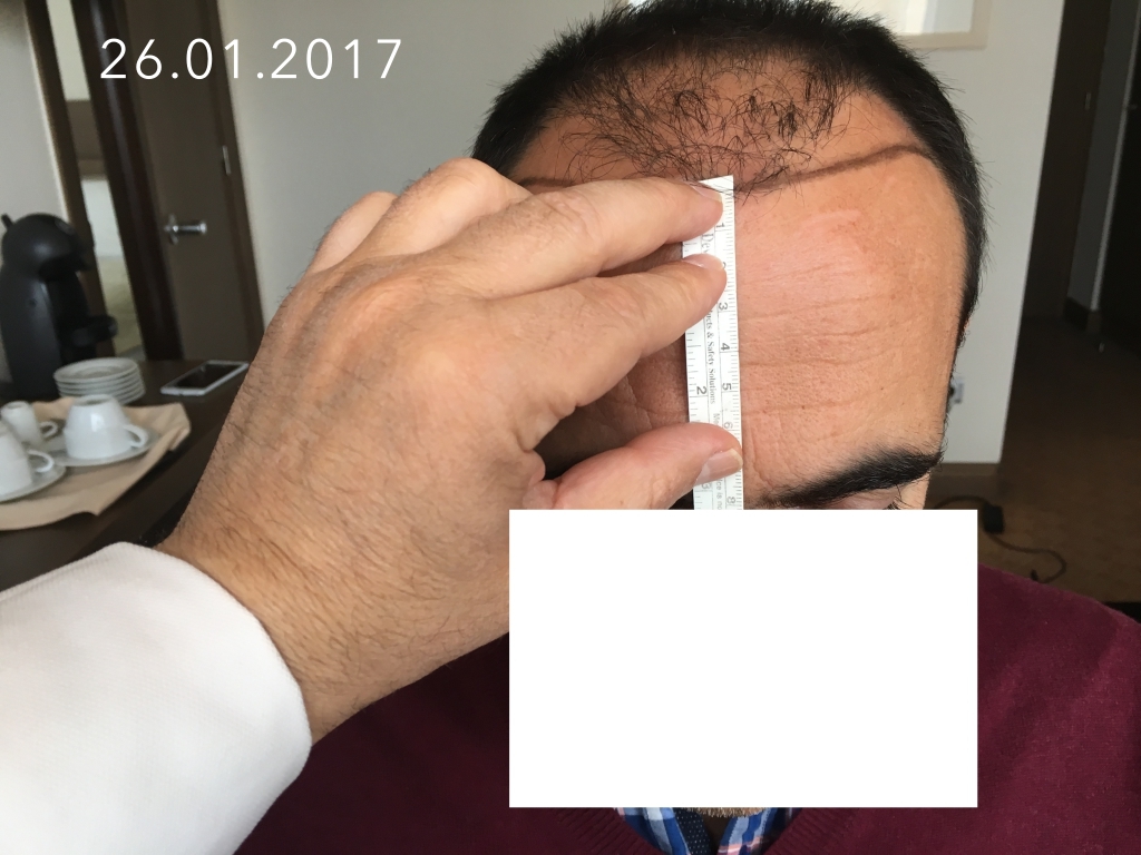 20170126_01.JPG