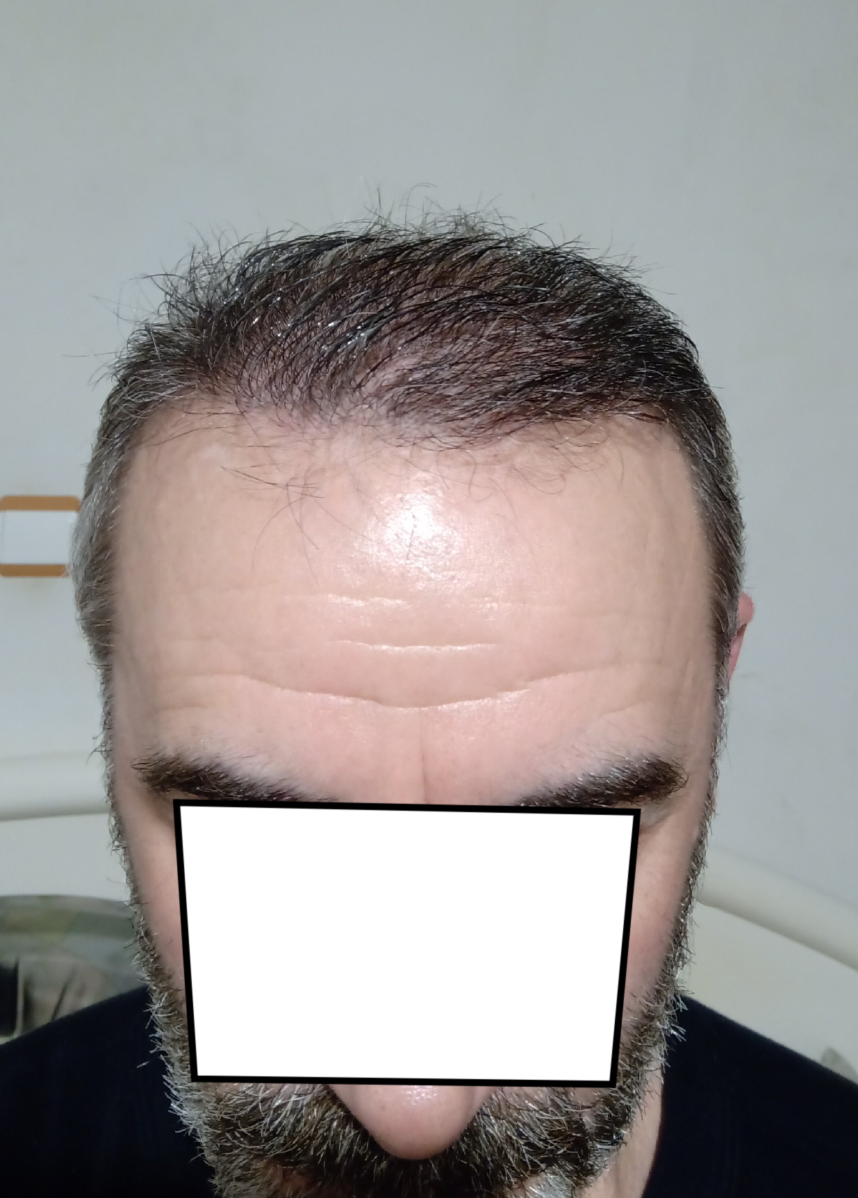20220220_212356.png