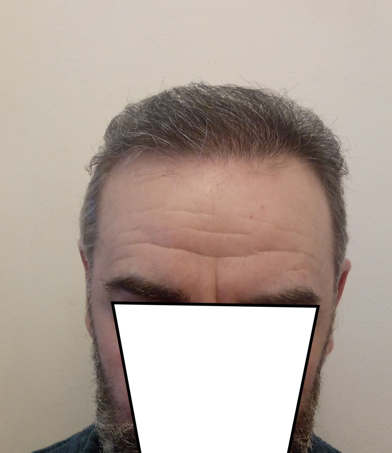20220319_184953.png