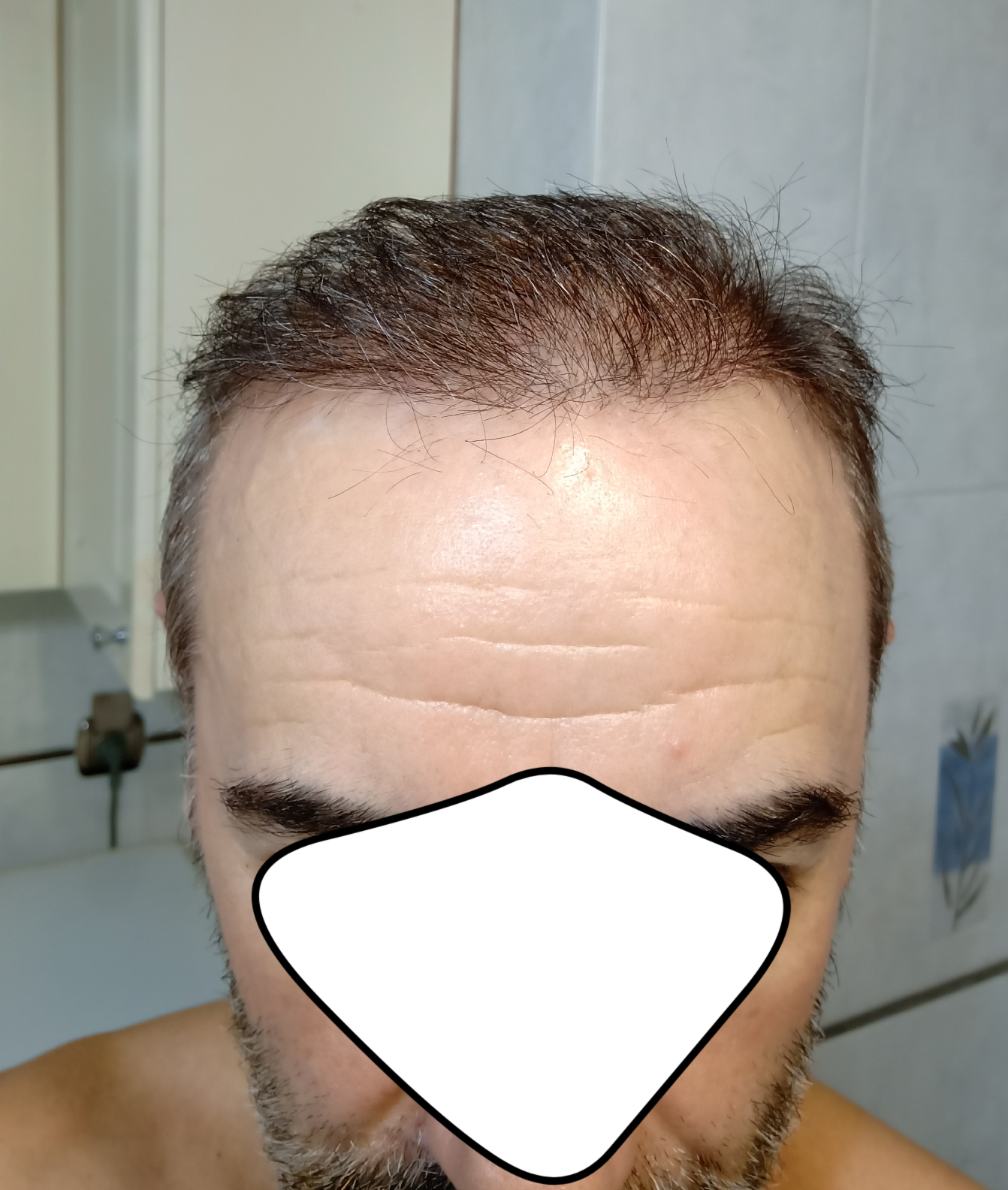 20220917_180333.png
