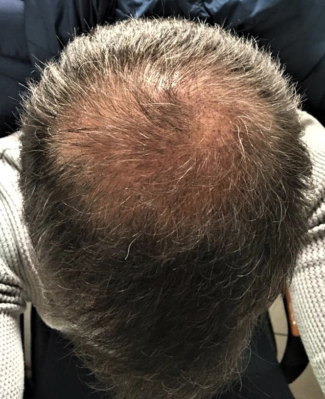 3.5-4.5 months 2.jpg