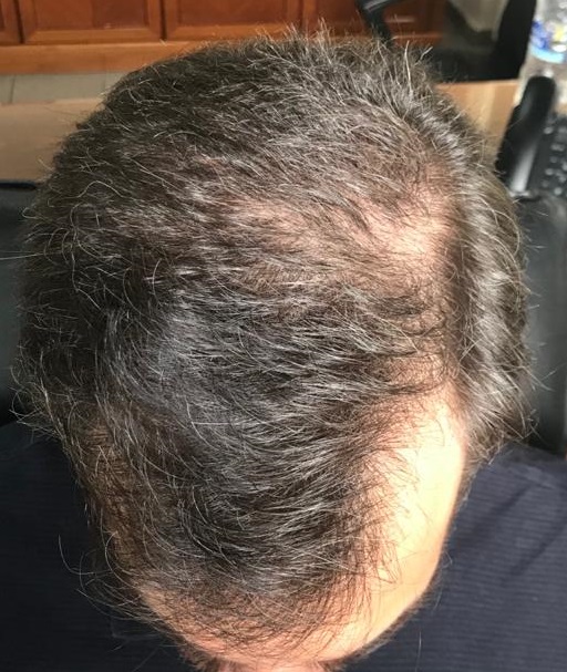 3.5-4.5 months 5.jpg
