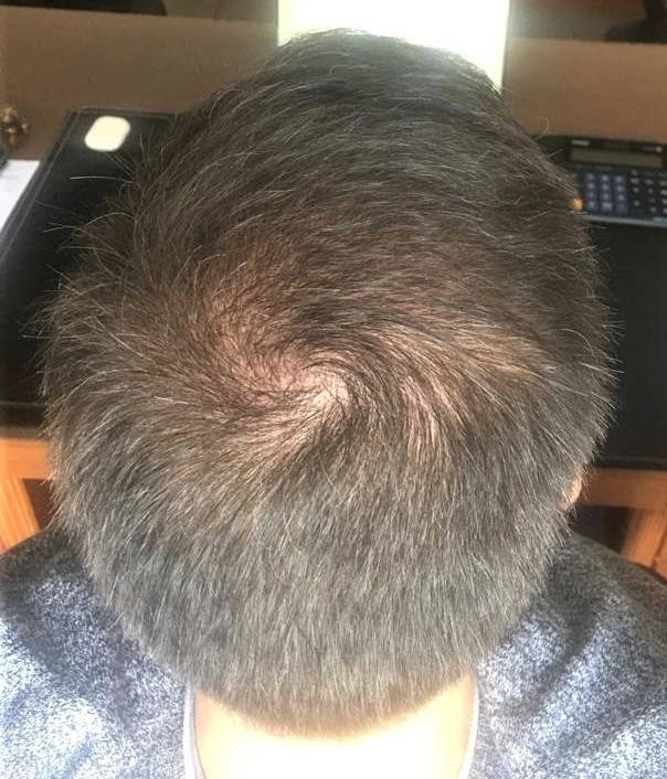 3.5-4.5 months.jpg