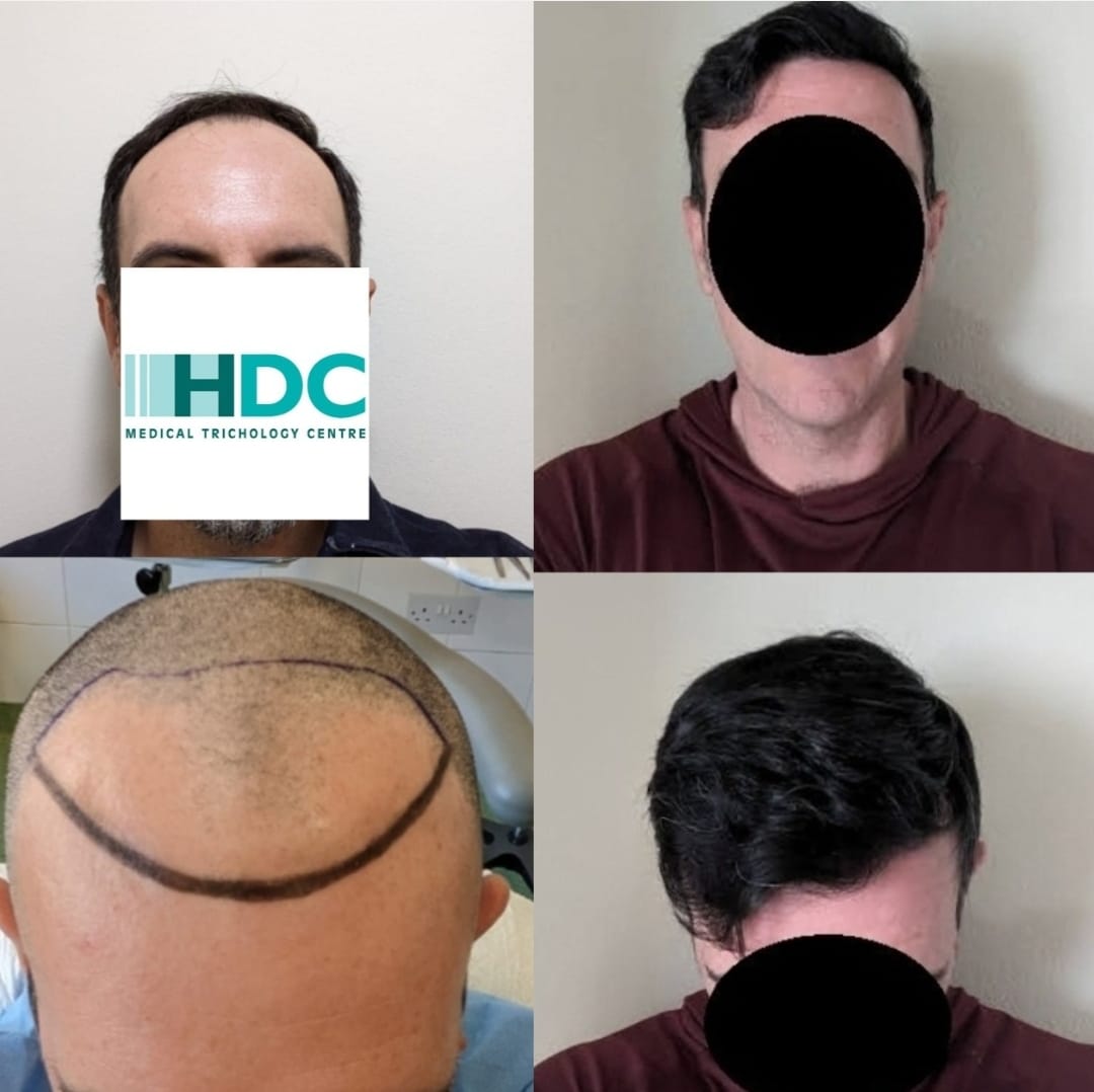 3520 Grafts.jpg