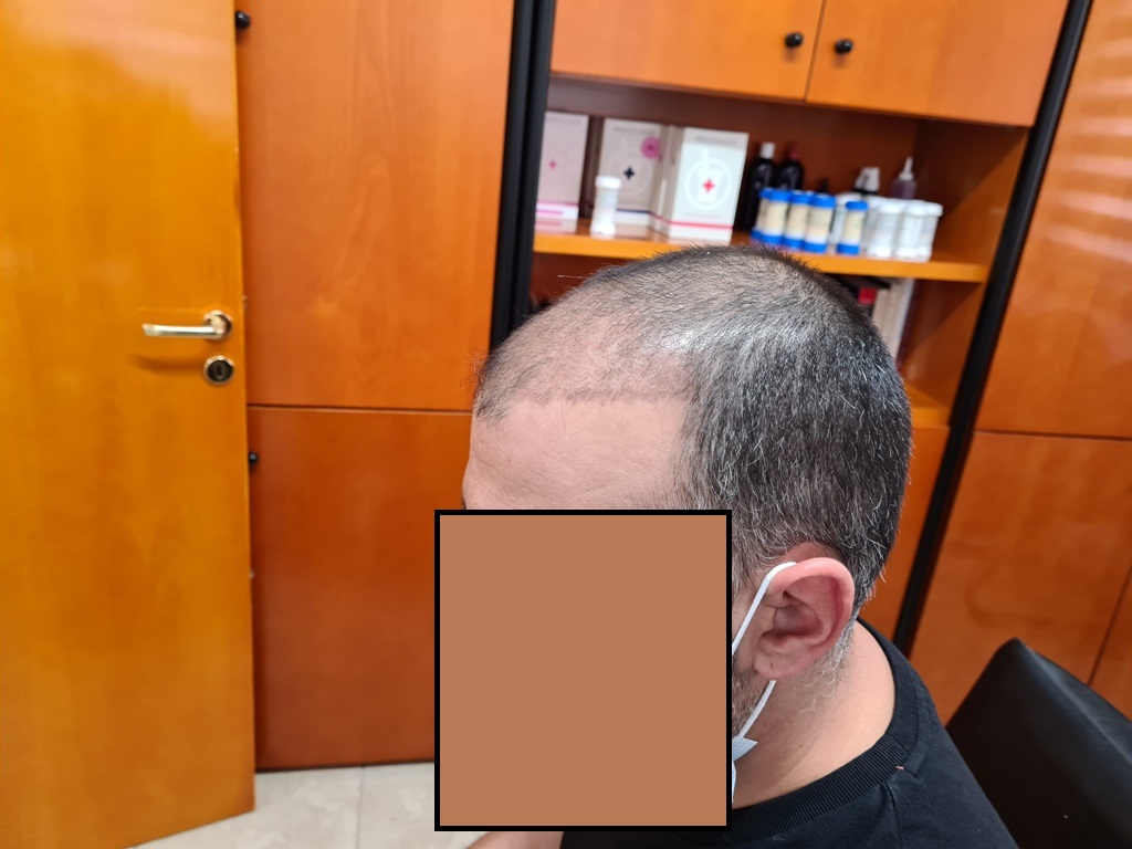 43.2 Μηνες.jpg