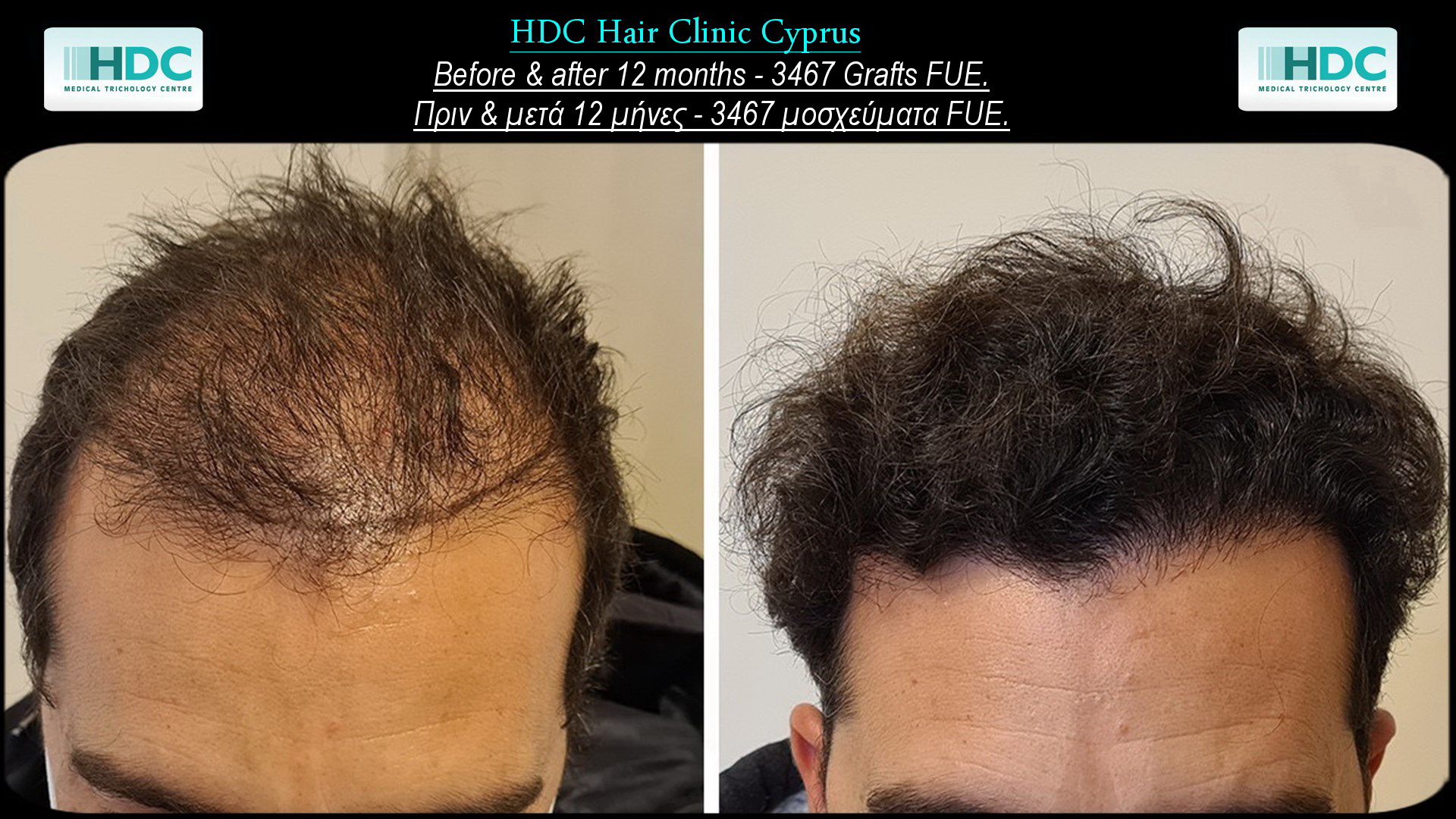55-3467 Grafts.jpg
