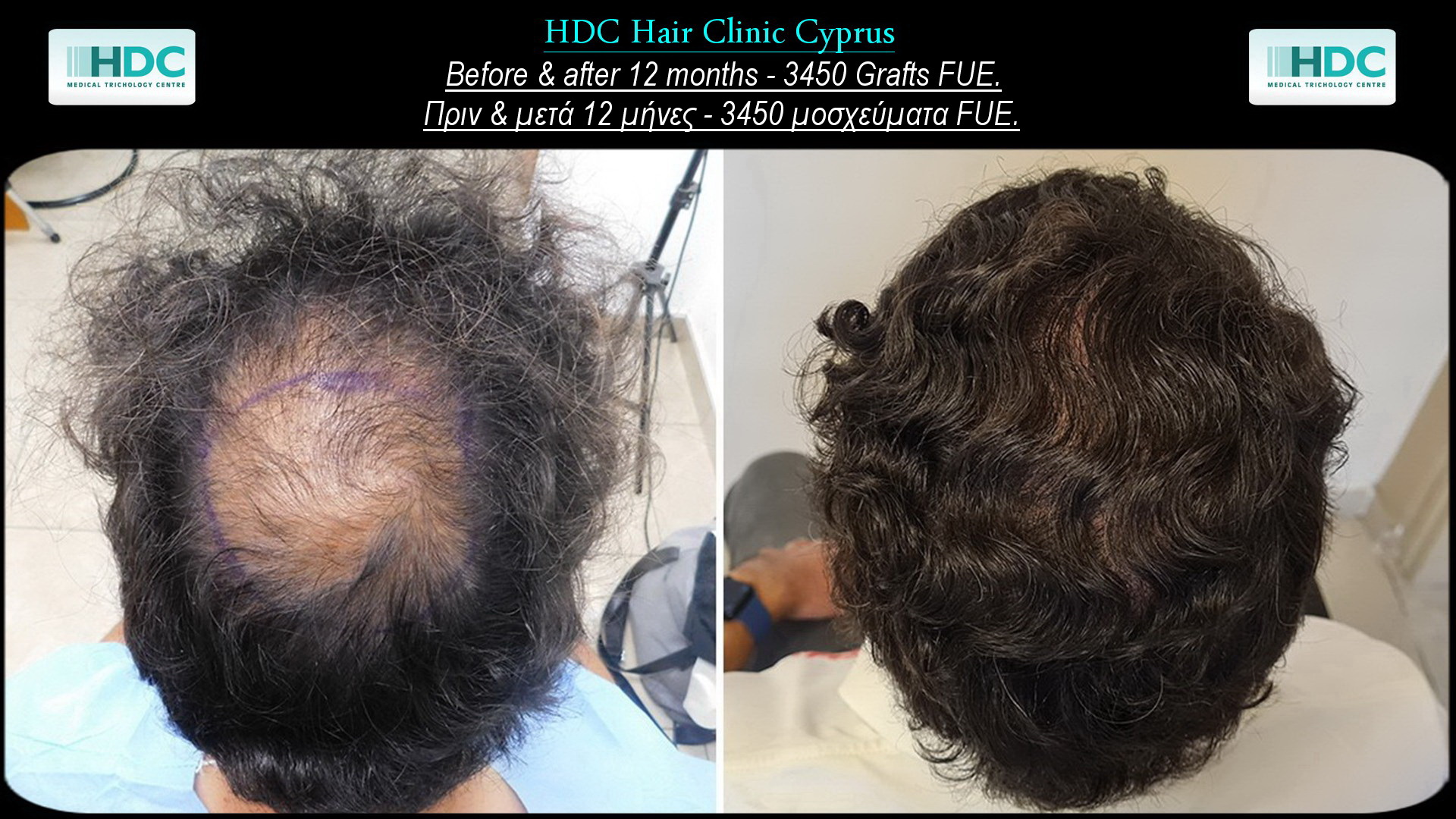 56-3450 Grafts.jpg