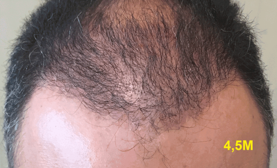 5months.gif