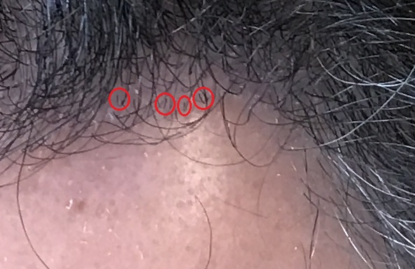 6.5monthsr.jpg