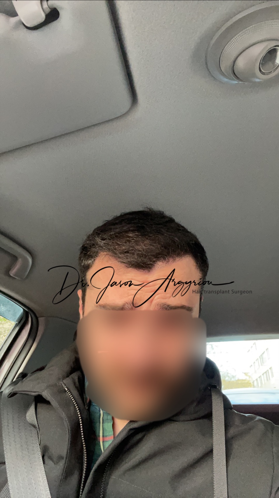 6months post-op.JPG