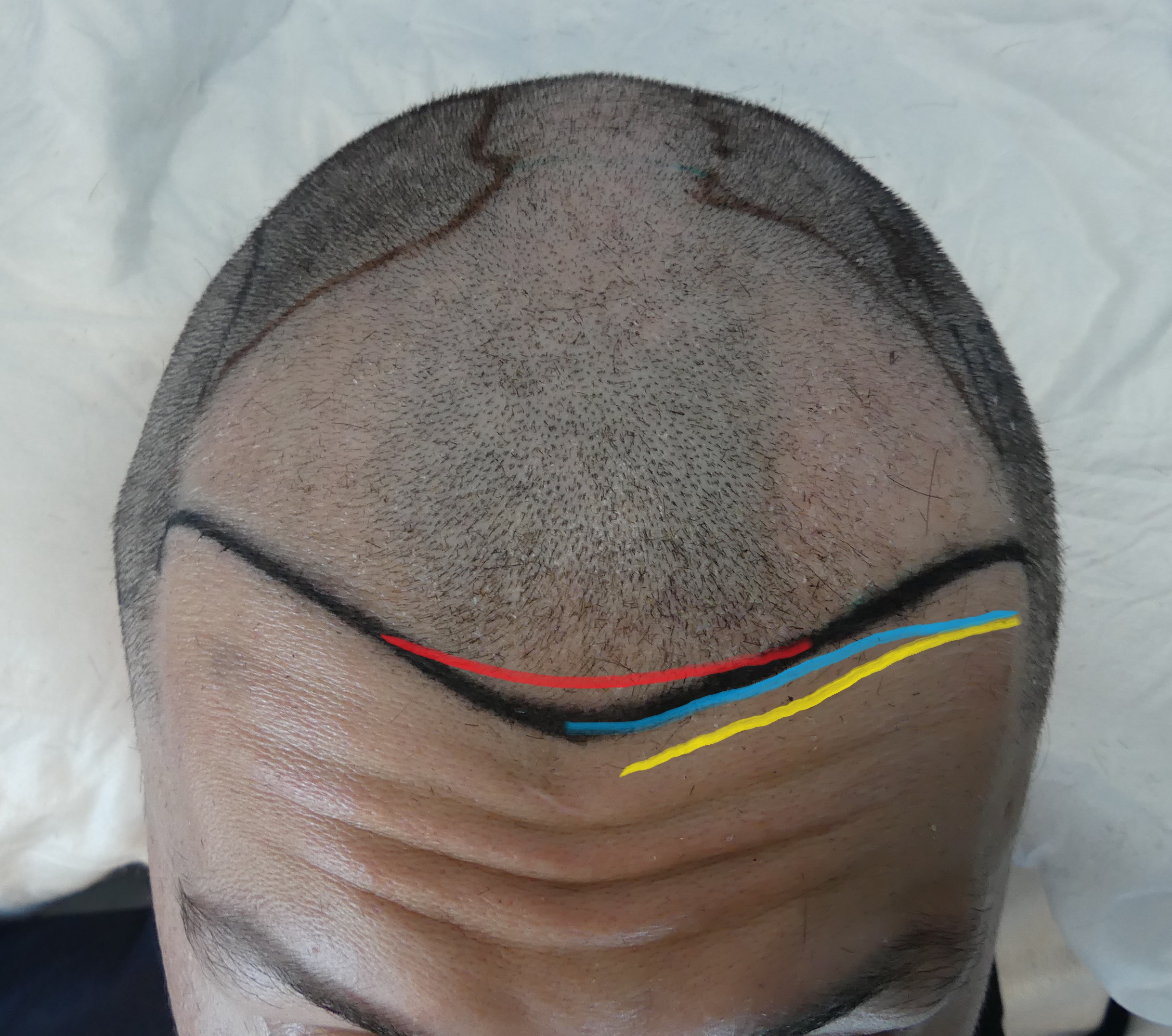 6TT25.06.22S1rr.jpg