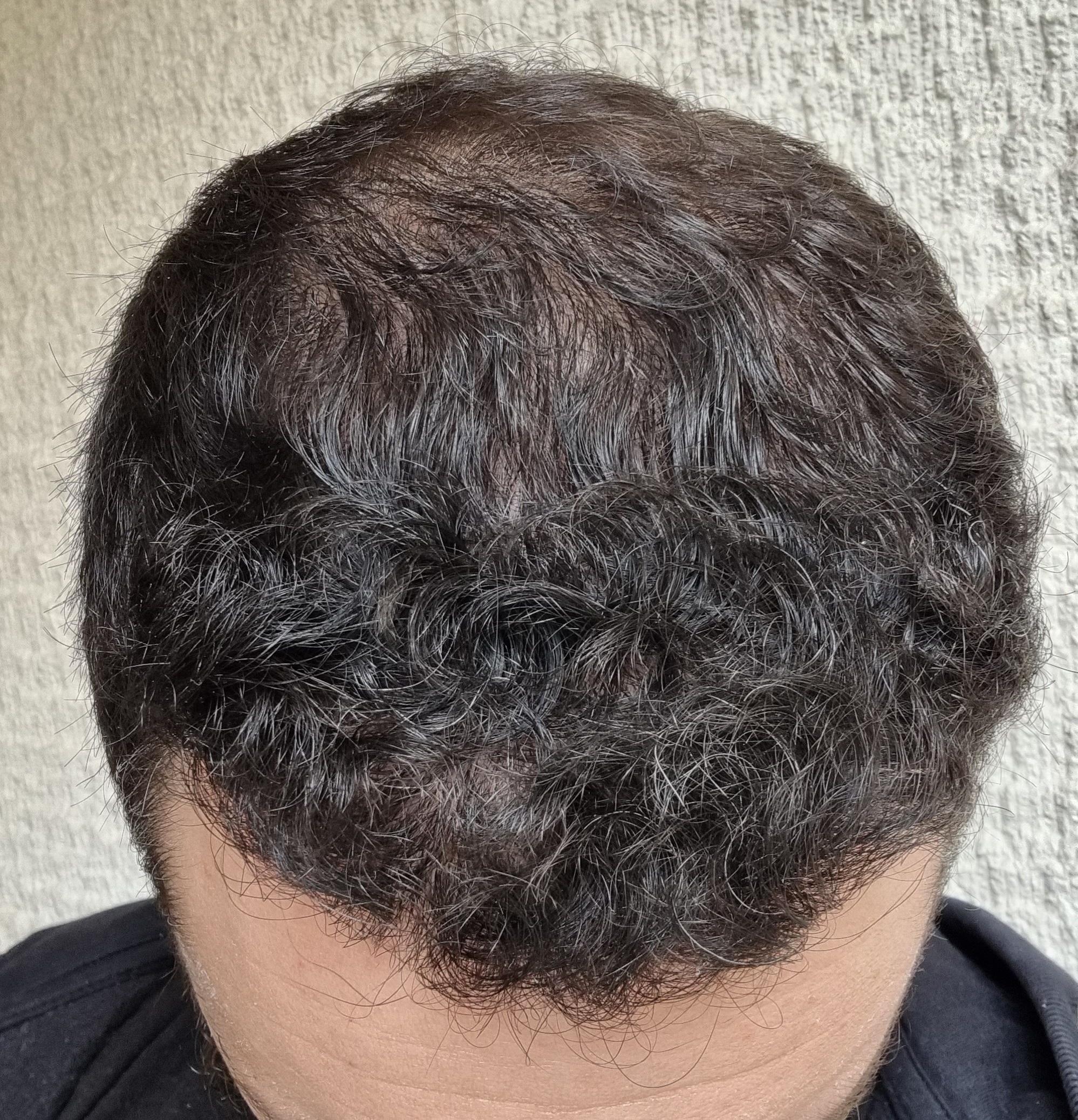 after.jpg