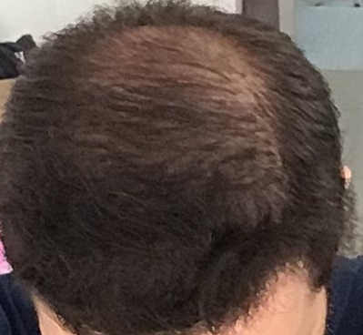 after_7months_c.jpg