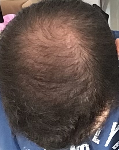 after_7months_e.jpg