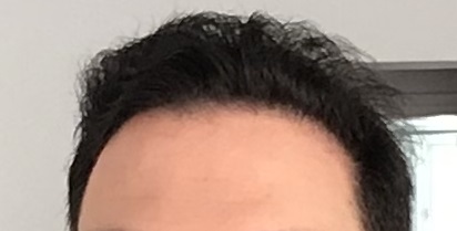 after_7months_g.jpg