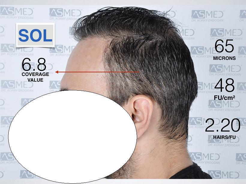 ANALİZ KEYNOTE.007.jpeg