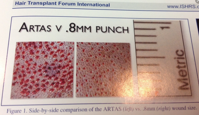 artas vs 8mm punch.png