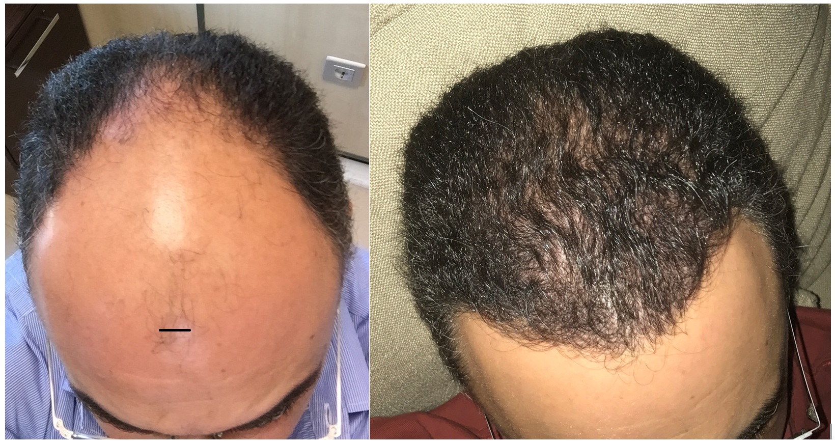 before after.jpg